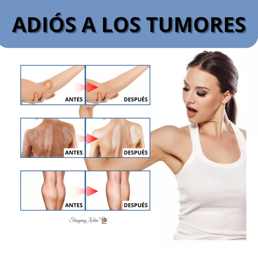 LipoZen - Spray Natural para Reducir Lipomas